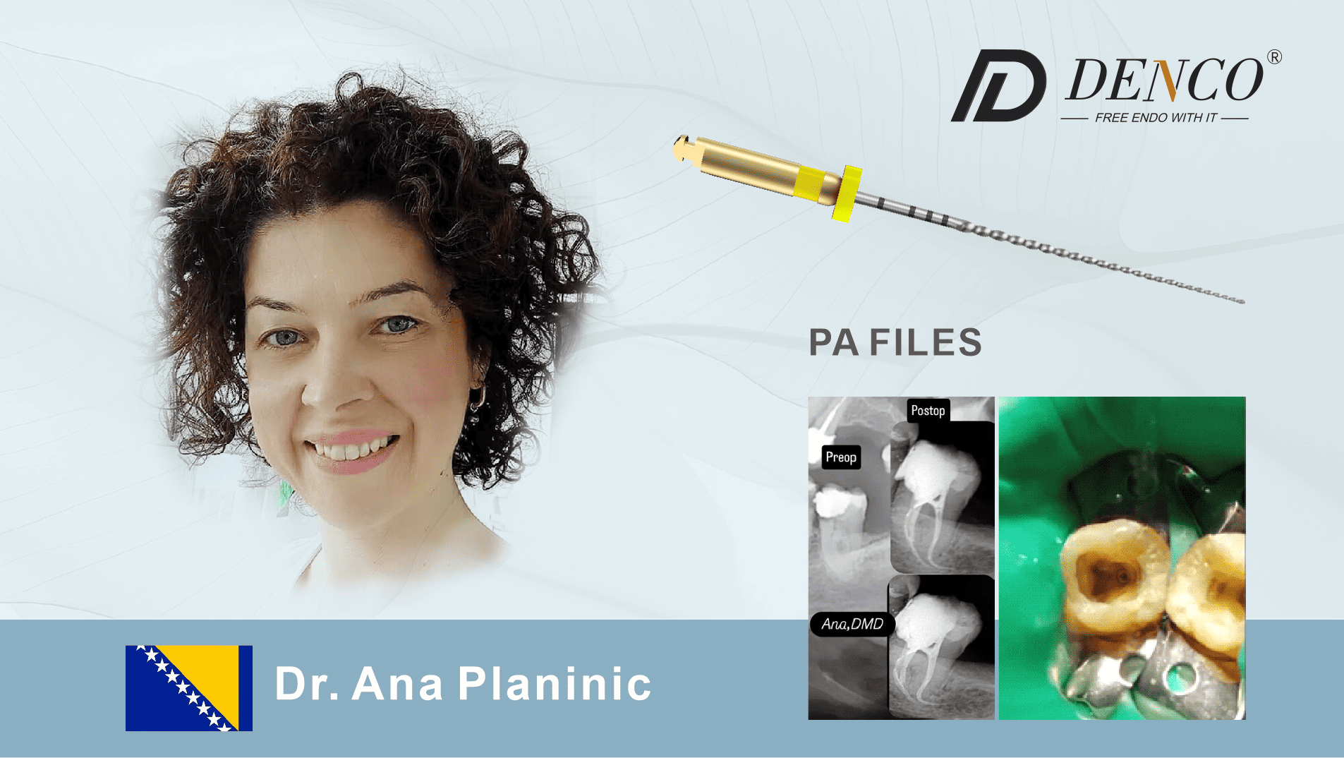 PA 锉如何革新复杂弯曲根管治疗：Ana Planinic 医生的案例研究